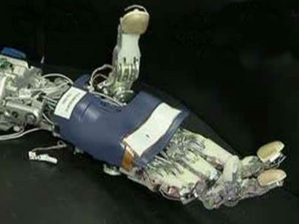 బోయినిక్ ఆర్మ్ (DARPA's Bionic Arm)
