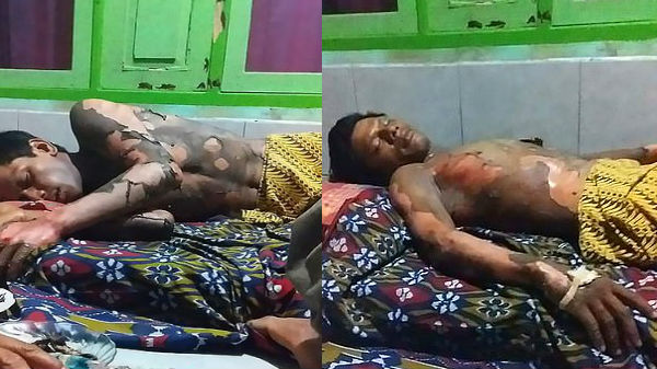 రెండు రోజుల చికిత్స అనంతరం మృతి చెందాడు...