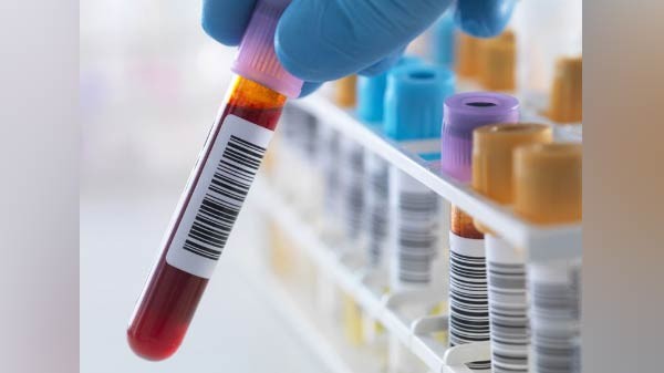 Measure Your Blood Alcohol Content